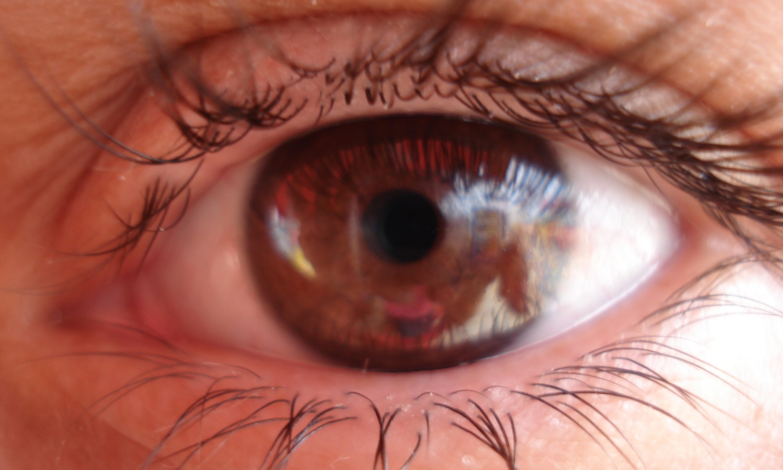 eye.jpeg